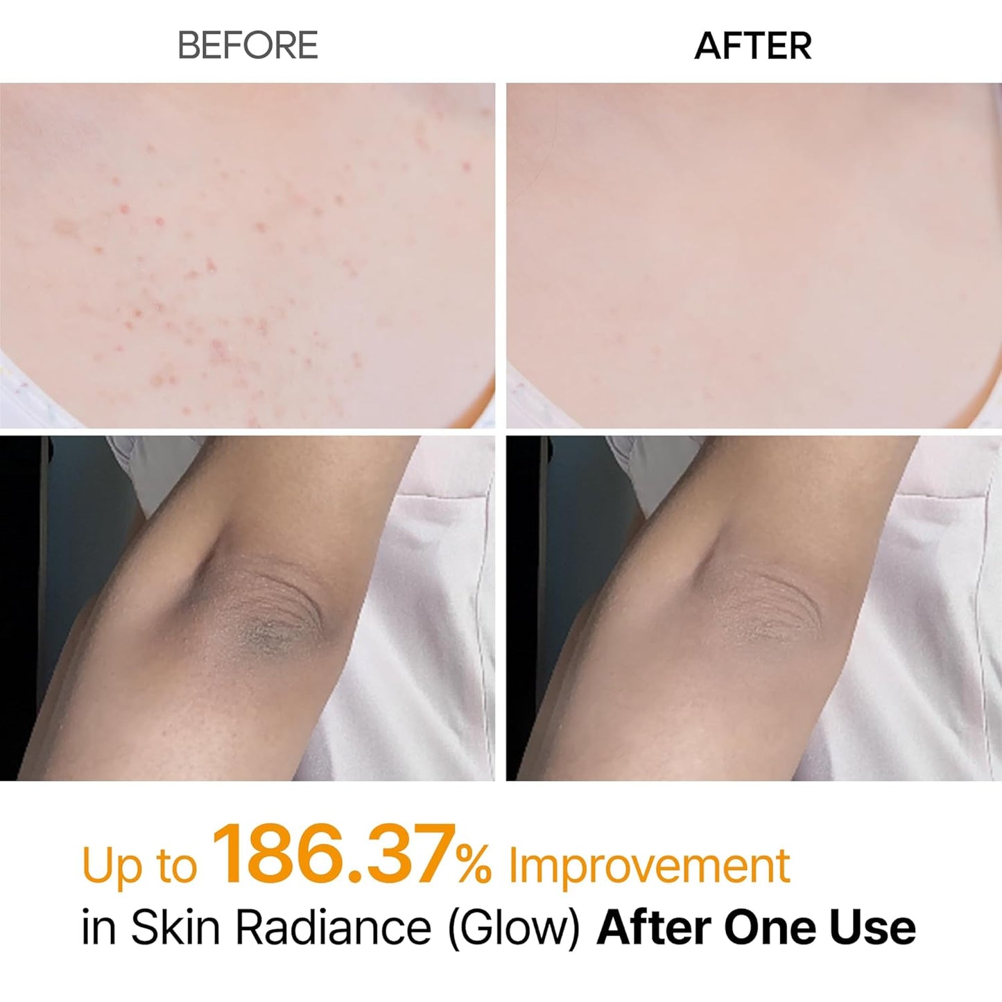 Dr. Melaxin Peel Shot Turmeric Spray [Korean Skincare]