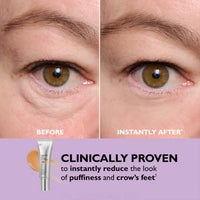 Elixeye™ Instant Eye Tightener