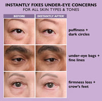 Elixeye™ Instant Eye Tightener