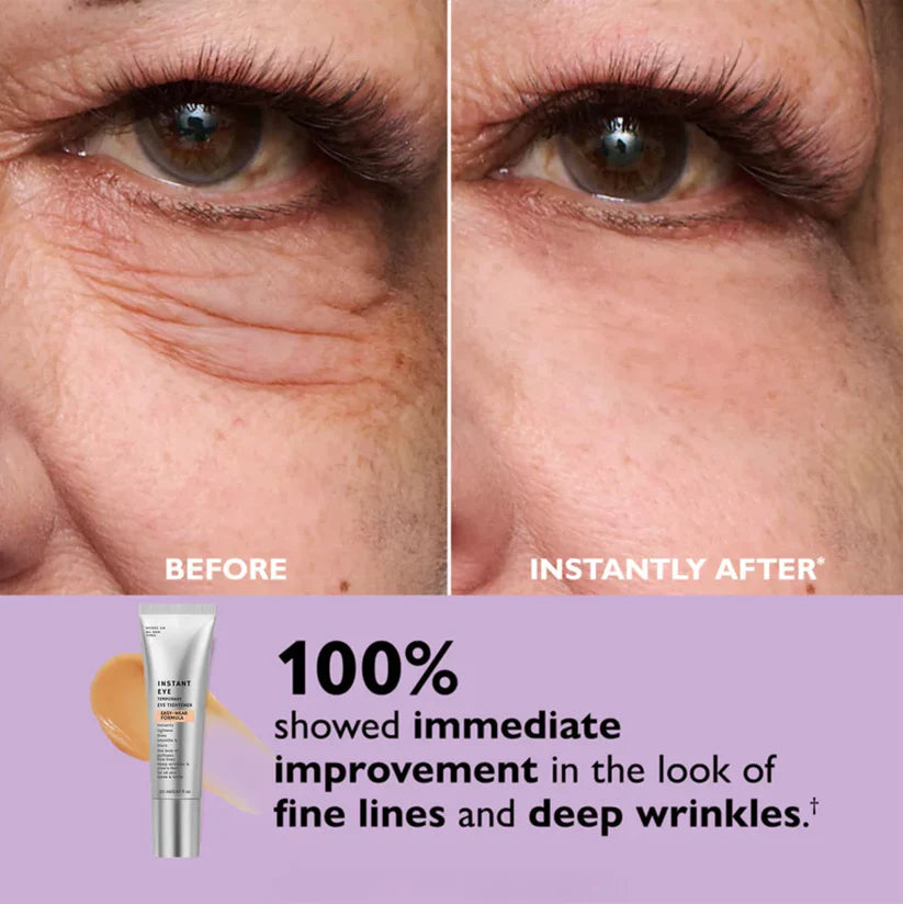 Elixeye™ Instant Eye Tightener