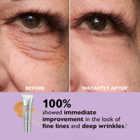 Elixeye™ Instant Eye Tightener